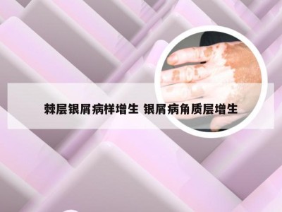 棘层银屑病样增生 银屑病角质层增生