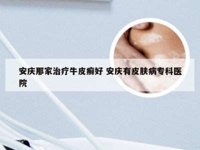 安庆那家治疗牛皮癣好 安庆有皮肤病专科医院