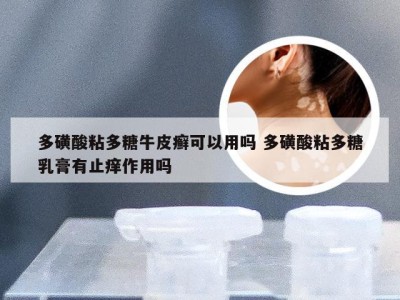多磺酸粘多糖牛皮癣可以用吗 多磺酸粘多糖乳膏有止痒作用吗