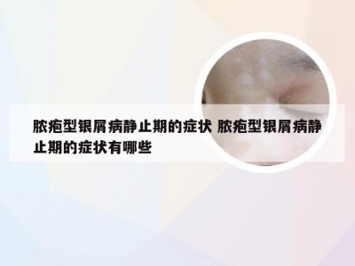 脓疱型银屑病静止期的症状 脓疱型银屑病静止期的症状有哪些