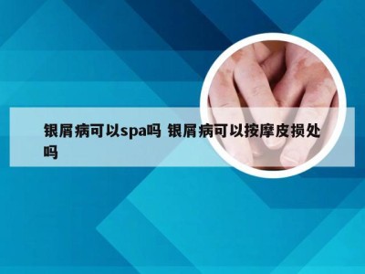 银屑病可以spa吗 银屑病可以按摩皮损处吗