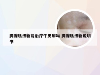 胸腺肽法新能治疗牛皮癣吗 胸腺肽法新说明书