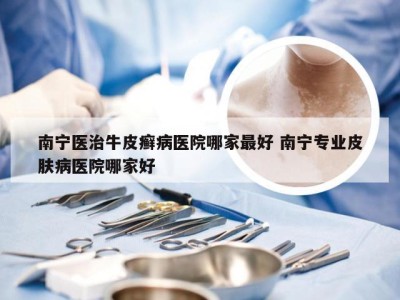 南宁医治牛皮癣病医院哪家最好 南宁专业皮肤病医院哪家好