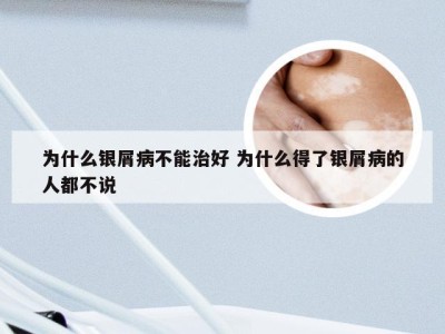 为什么银屑病不能治好 为什么得了银屑病的人都不说