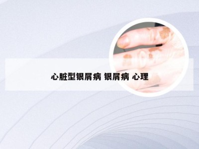 心脏型银屑病 银屑病 心理