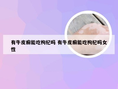 有牛皮癣能吃枸杞吗 有牛皮癣能吃枸杞吗女性