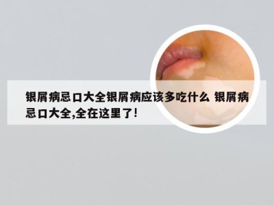 银屑病忌口大全银屑病应该多吃什么 银屑病忌口大全,全在这里了!