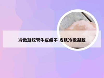 冷敷凝胶管牛皮癣不 皮肤冷敷凝胶
