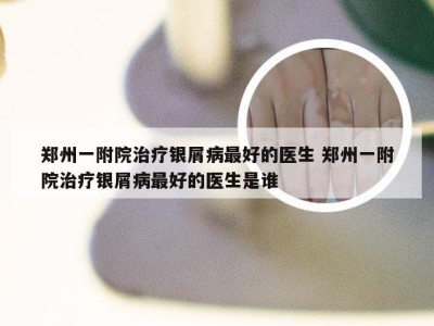 郑州一附院治疗银屑病最好的医生 郑州一附院治疗银屑病最好的医生是谁