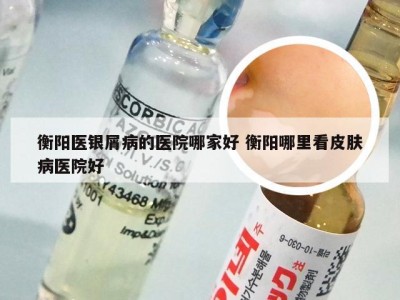 衡阳医银屑病的医院哪家好 衡阳哪里看皮肤病医院好