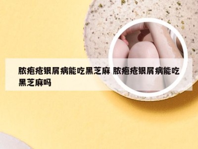 脓疱疮银屑病能吃黑芝麻 脓疱疮银屑病能吃黑芝麻吗
