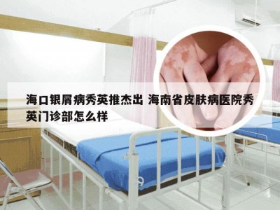 海口银屑病秀英推杰出 海南省皮肤病医院秀英门诊部怎么样