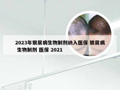 2023年银屑病生物制剂纳入医保 银屑病 生物制剂 医保 2021