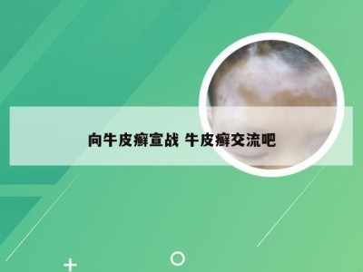向牛皮癣宣战 牛皮癣交流吧