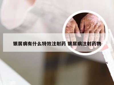银屑病有什么特效注射药 银屑病注射药物