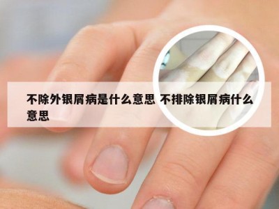 不除外银屑病是什么意思 不排除银屑病什么意思