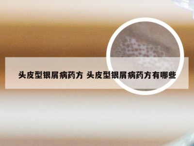 头皮型银屑病药方 头皮型银屑病药方有哪些