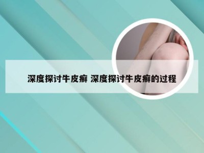 深度探讨牛皮癣 深度探讨牛皮癣的过程