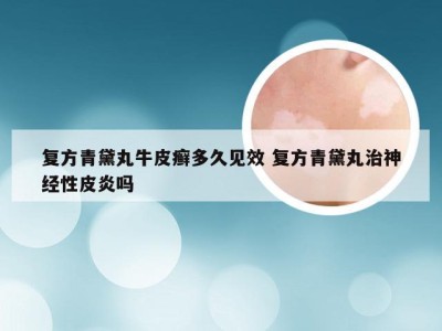 复方青黛丸牛皮癣多久见效 复方青黛丸治神经性皮炎吗