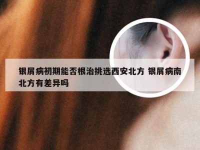 银屑病初期能否根治挑选西安北方 银屑病南北方有差异吗