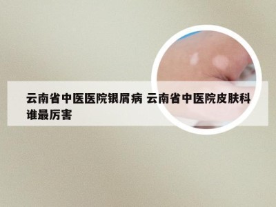 云南省中医医院银屑病 云南省中医院皮肤科谁最厉害