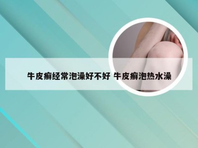 牛皮癣经常泡澡好不好 牛皮癣泡热水澡