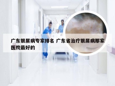 广东银屑病专家排名 广东省治疗银屑病那家医院最好的