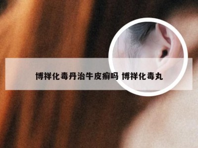 博祥化毒丹治牛皮癣吗 博祥化毒丸