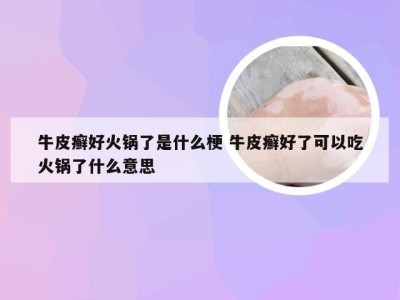 牛皮癣好火锅了是什么梗 牛皮癣好了可以吃火锅了什么意思
