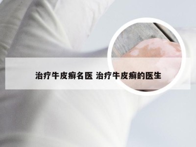 治疗牛皮癣名医 治疗牛皮癣的医生