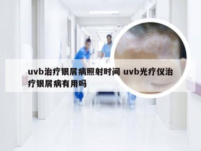 uvb治疗银屑病照射时间 uvb光疗仪治疗银屑病有用吗