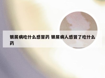 银屑病吃什么感冒药 银屑病人感冒了吃什么药