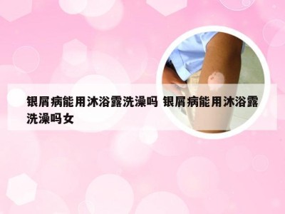 银屑病能用沐浴露洗澡吗 银屑病能用沐浴露洗澡吗女