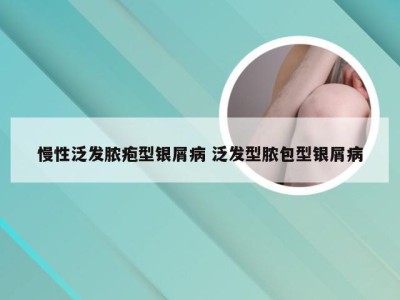 慢性泛发脓疱型银屑病 泛发型脓包型银屑病