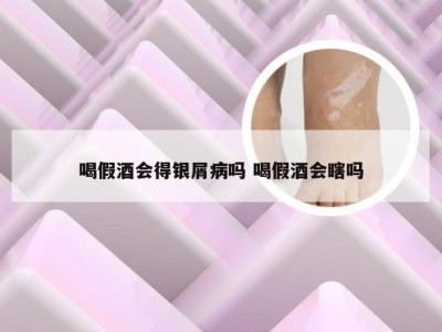 喝假酒会得银屑病吗 喝假酒会瞎吗
