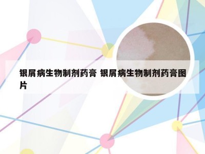 银屑病生物制剂药膏 银屑病生物制剂药膏图片