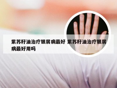 紫苏籽油治疗银屑病最好 紫苏籽油治疗银屑病最好用吗