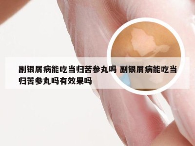 副银屑病能吃当归苦参丸吗 副银屑病能吃当归苦参丸吗有效果吗