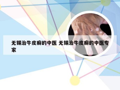 无锡治牛皮癣的中医 无锡治牛皮癣的中医专家