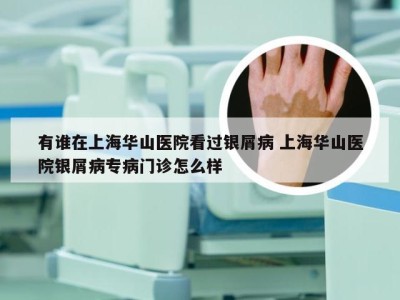 有谁在上海华山医院看过银屑病 上海华山医院银屑病专病门诊怎么样