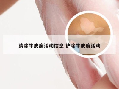 清除牛皮癣活动信息 铲除牛皮癣活动