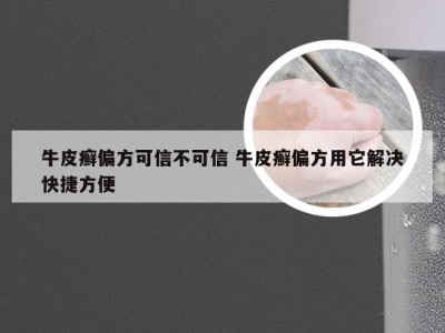 牛皮癣偏方可信不可信 牛皮癣偏方用它解决快捷方便