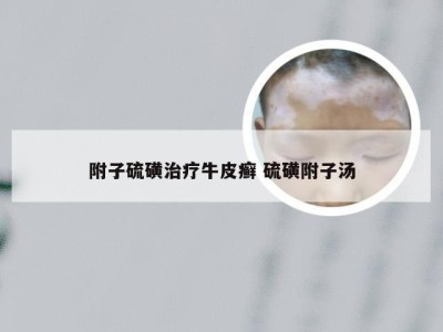 附子硫磺治疗牛皮癣 硫磺附子汤