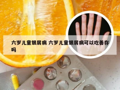 六岁儿童银屑病 六岁儿童银屑病可以吃善存吗