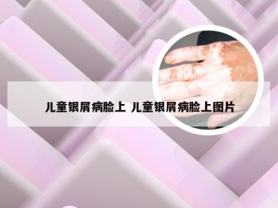 儿童银屑病脸上 儿童银屑病脸上图片