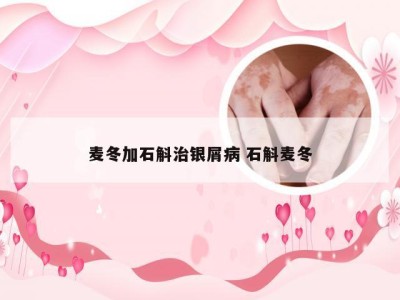 麦冬加石斛治银屑病 石斛麦冬