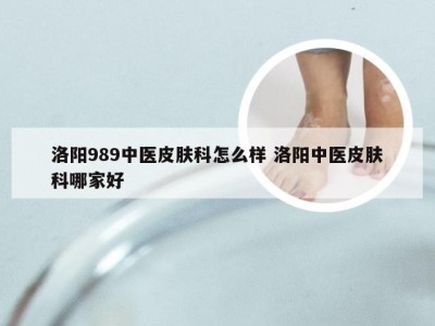 洛阳989中医皮肤科怎么样 洛阳中医皮肤科哪家好