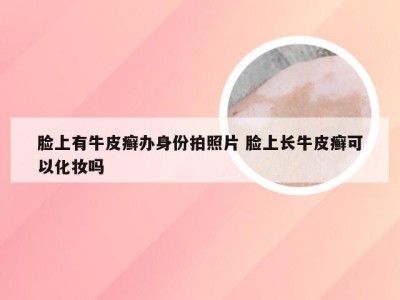 脸上有牛皮癣办身份拍照片 脸上长牛皮癣可以化妆吗