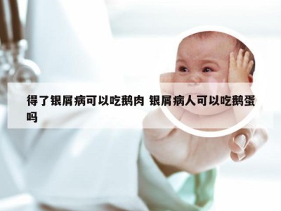 得了银屑病可以吃鹅肉 银屑病人可以吃鹅蛋吗