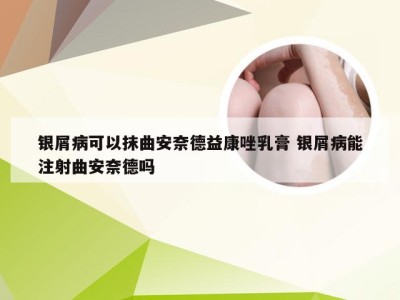 银屑病可以抹曲安奈德益康唑乳膏 银屑病能注射曲安奈德吗
